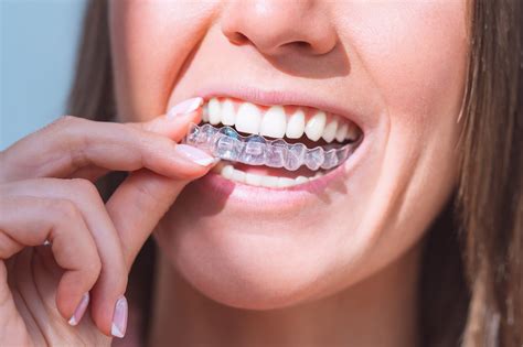 Common Myths About Invisalign Cleaning Debunked